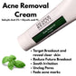 Acne Removal Cream