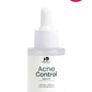 Acne Control Serum