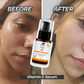 Glow Boost Vitamin C Serum